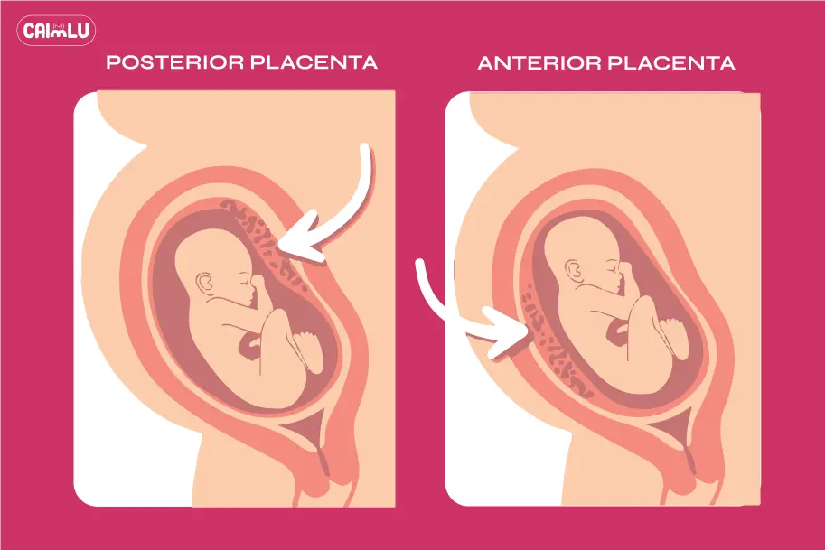 anterior-and-posterior-placenta-(Comparing-Anterior-and-Posterior-Placenta-)